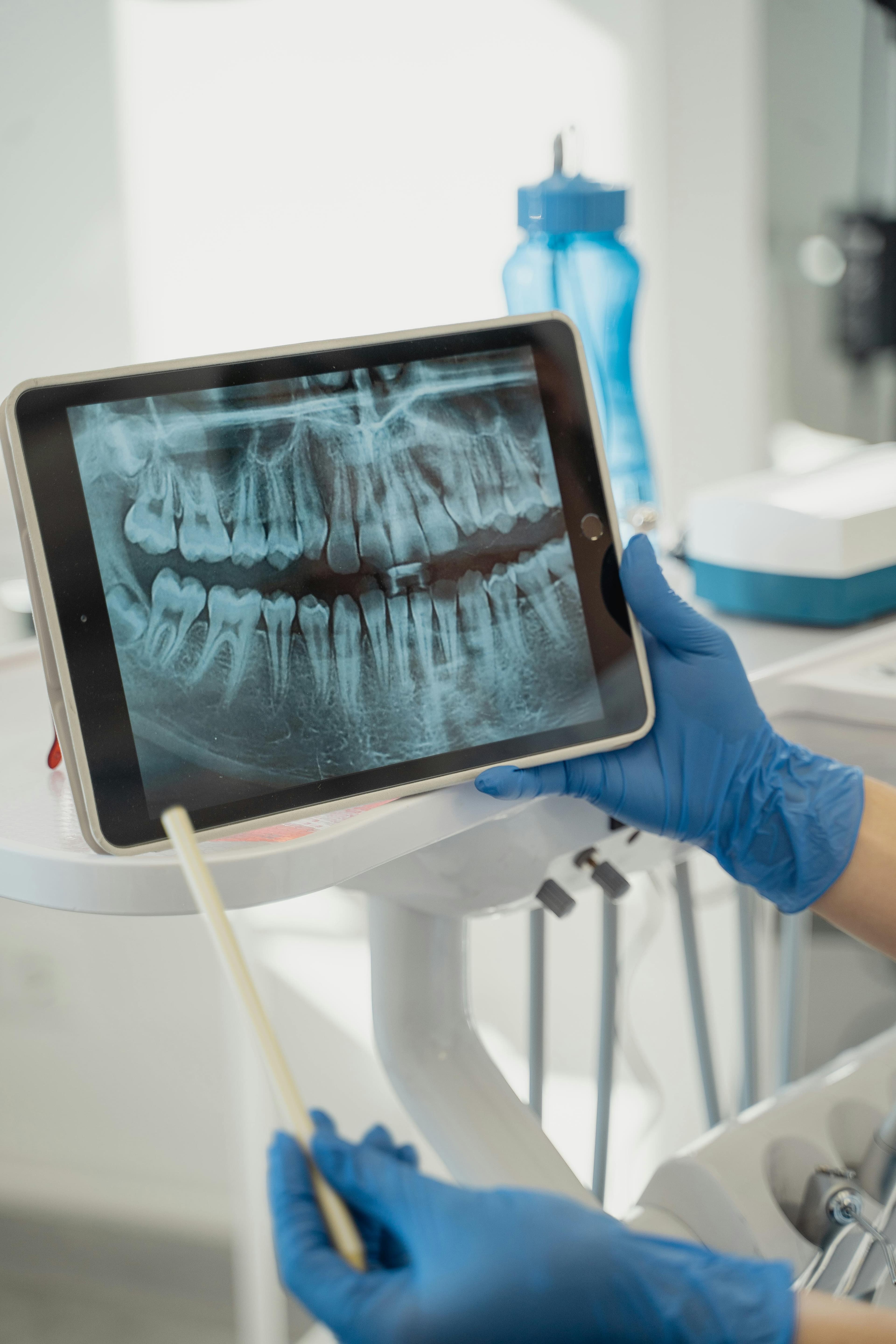 Dental x-ray on tablet screen